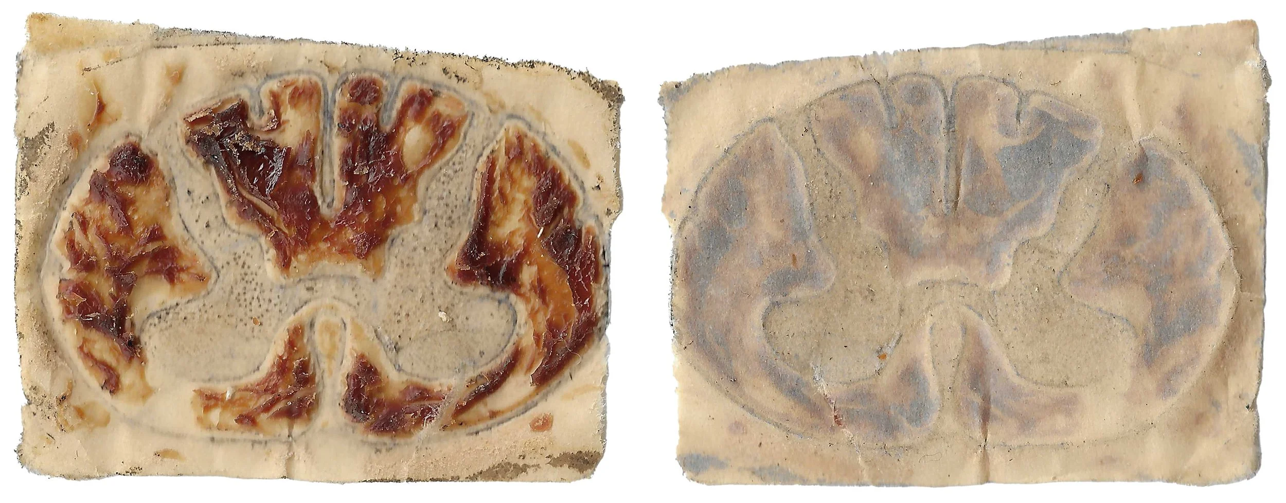 skin#62