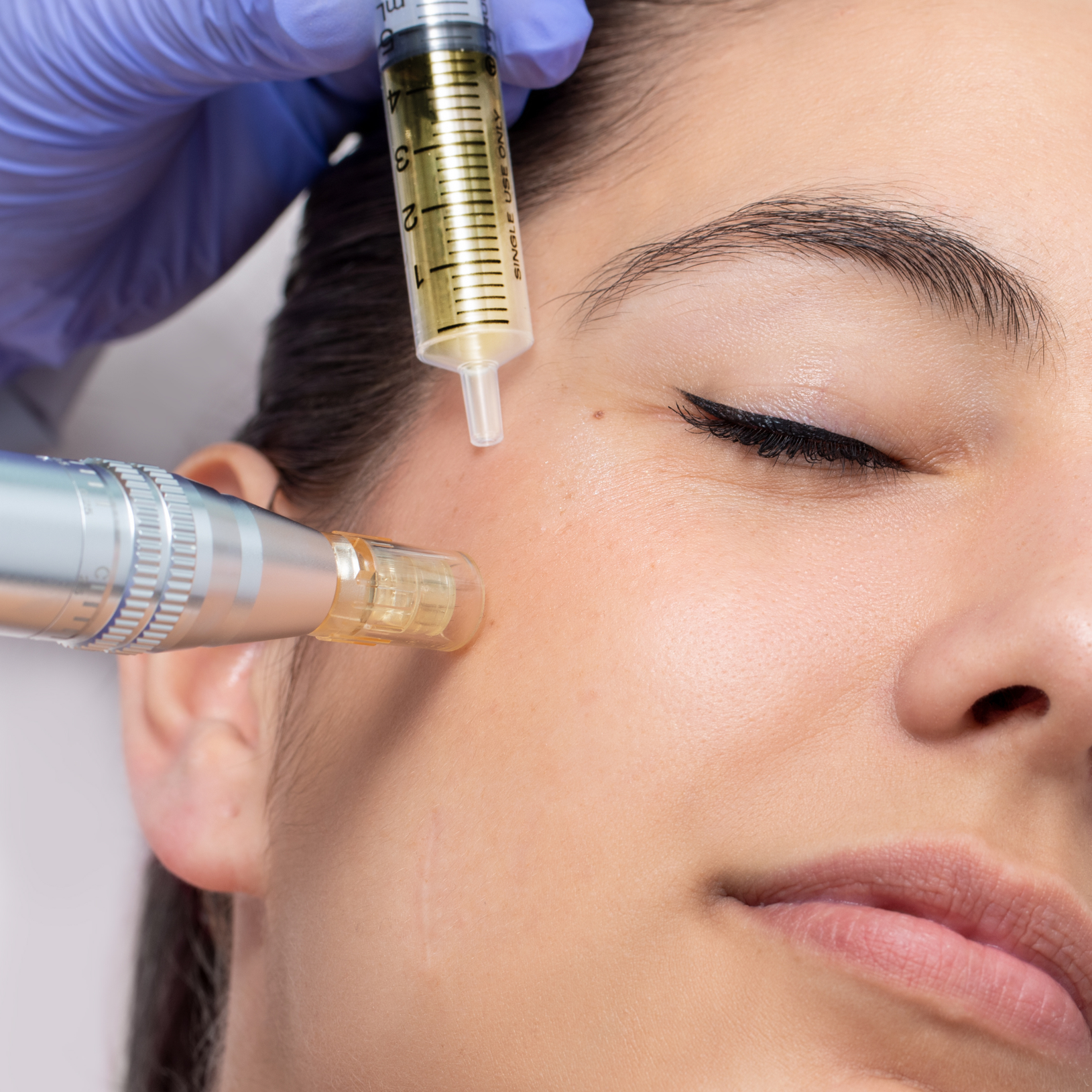 canva picture microneedling.png