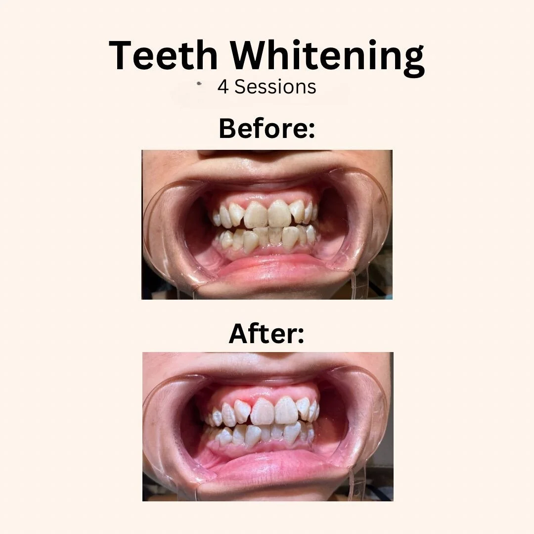 Add a little bit of body text.jpg