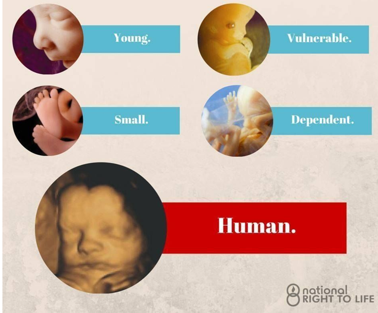 Either everyone matters or they don’t: A fundamental divide