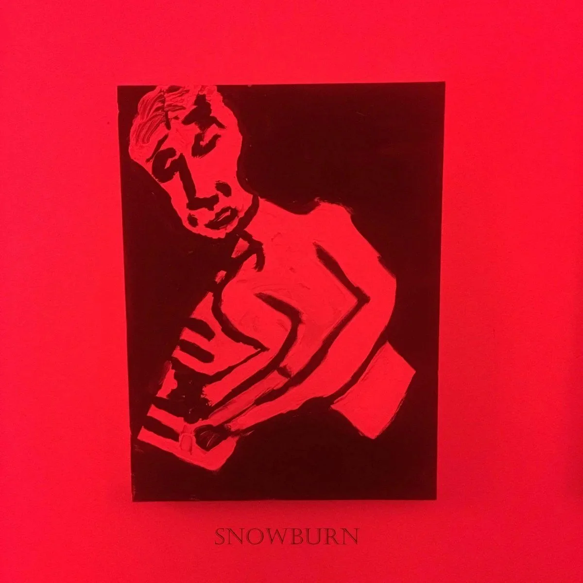 snowburn.jpg
