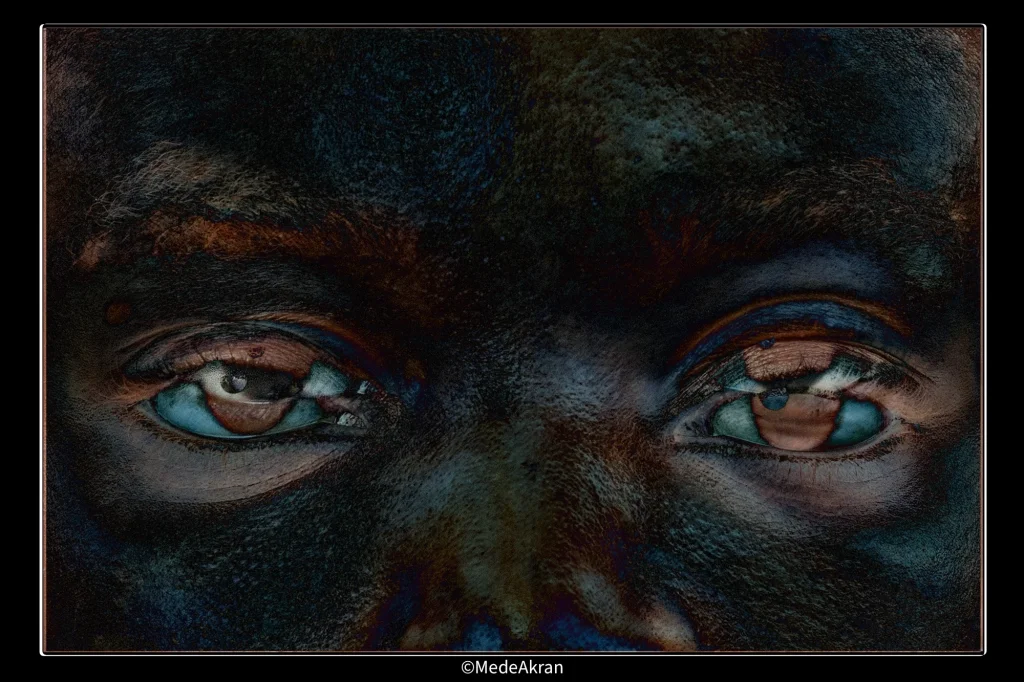 eye-combo-3 (1).webp
