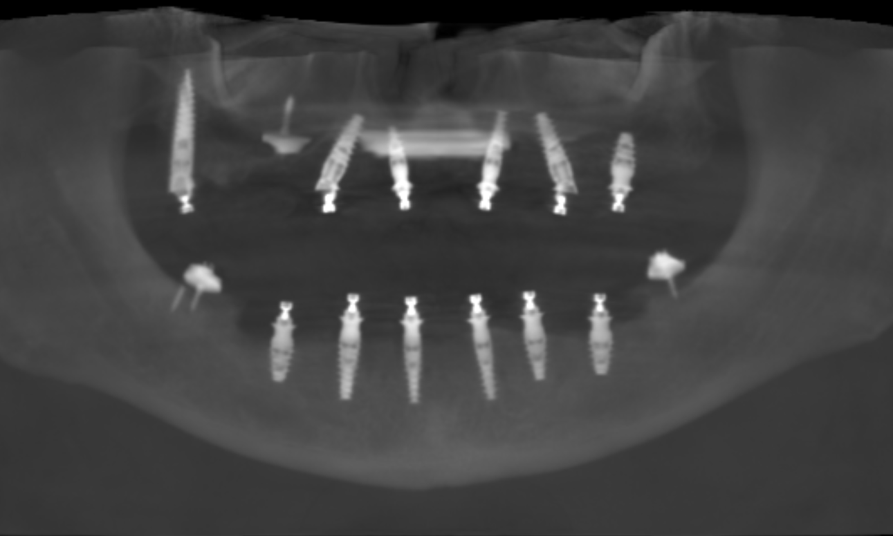 post op website img.png