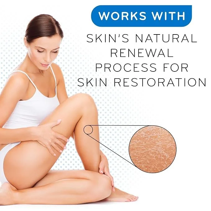AMLACTIN 
15% Cream
