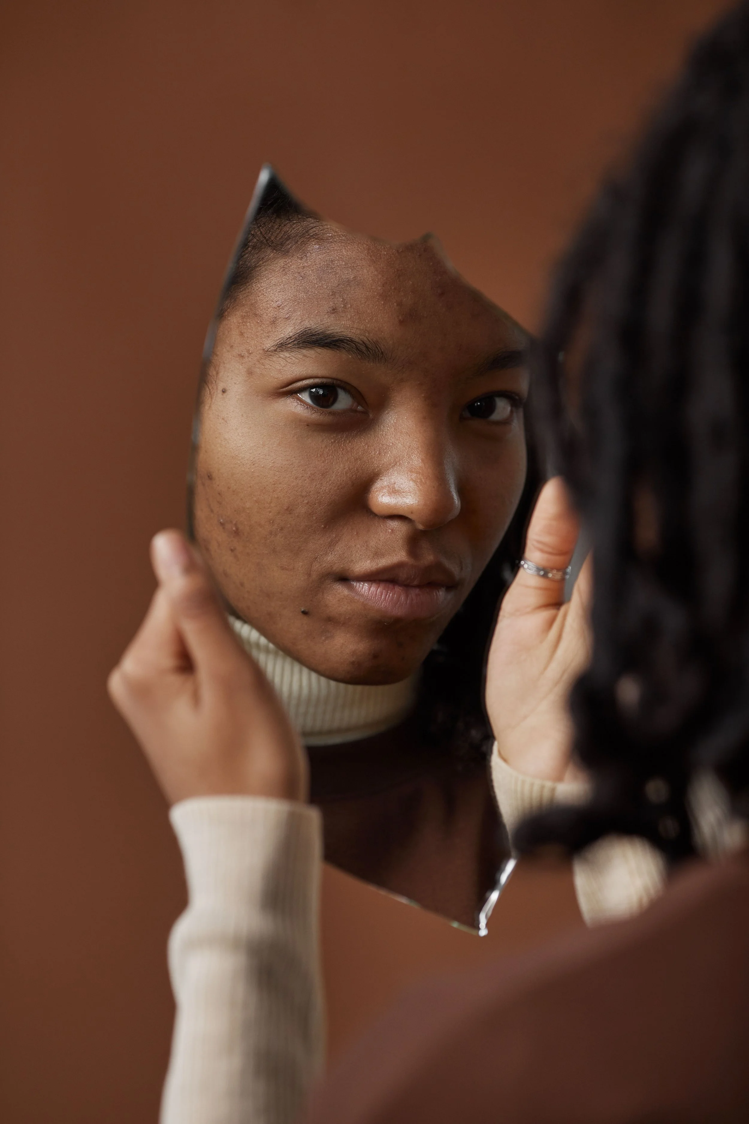 Person holding a hand mirror, looking at their face with acne and skin imperfections.