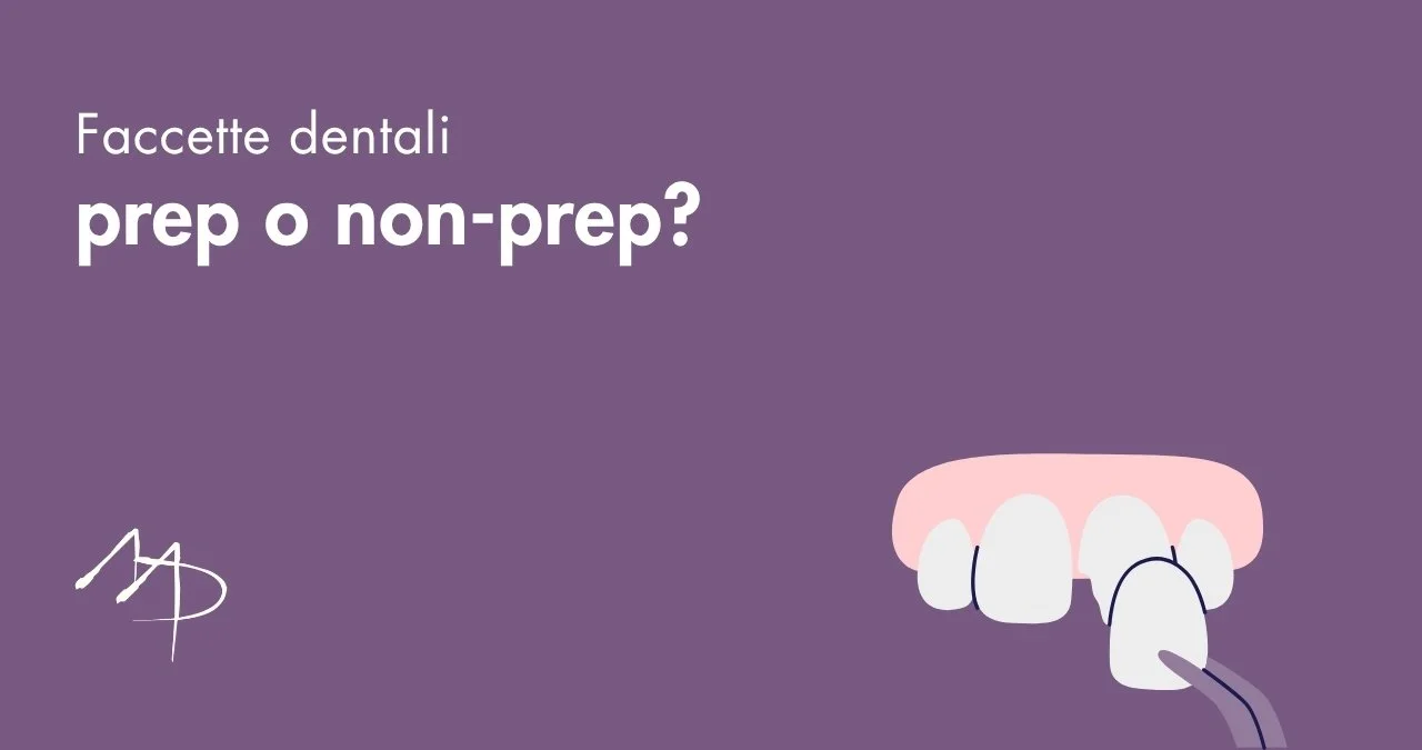 Faccette dentali: prep o no-prep? Sfatiamo il mito della "limatura dei denti"