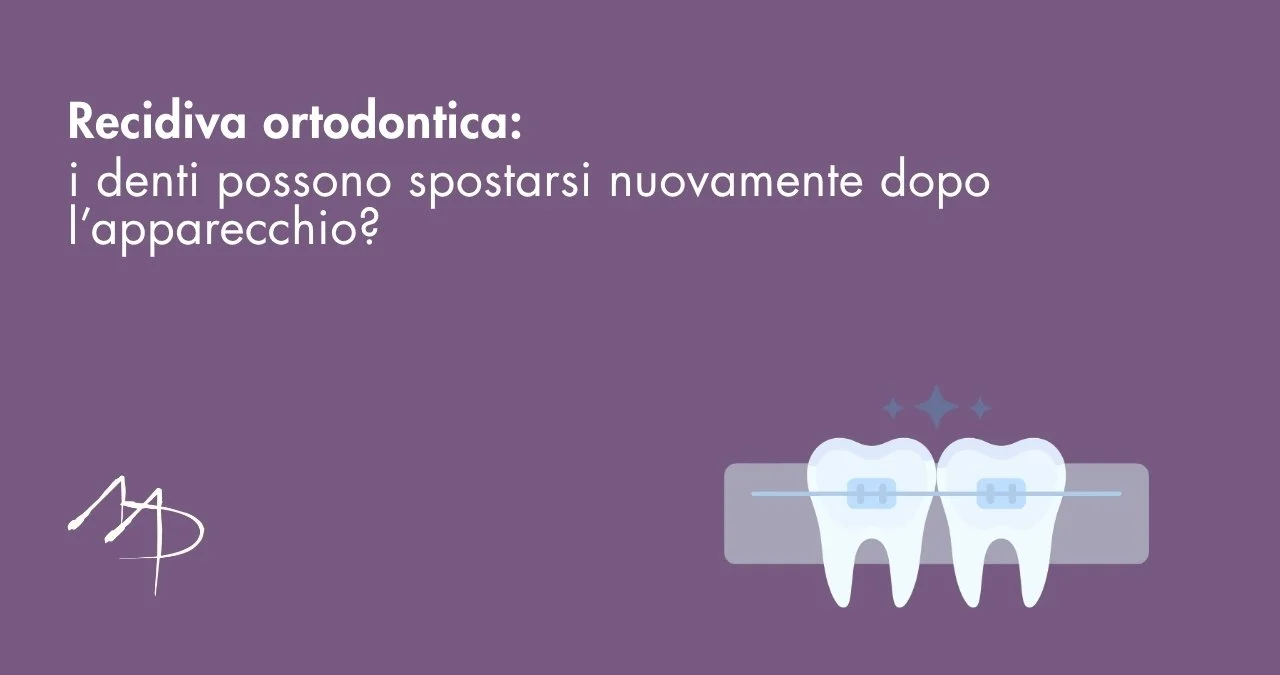 Recidiva ortodontica: quando i denti tornano indietro, il problema non è mai l'apparecchio