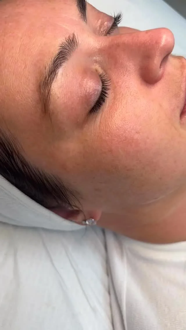 Fun fact - when you invest in a facial, you also get free therapy 😉 and don’t worry… your boss doesn’t need to know your therapy sessions come in the form of visiting Beam Beauty 🙊
My gorgeous client has been a dream at being co