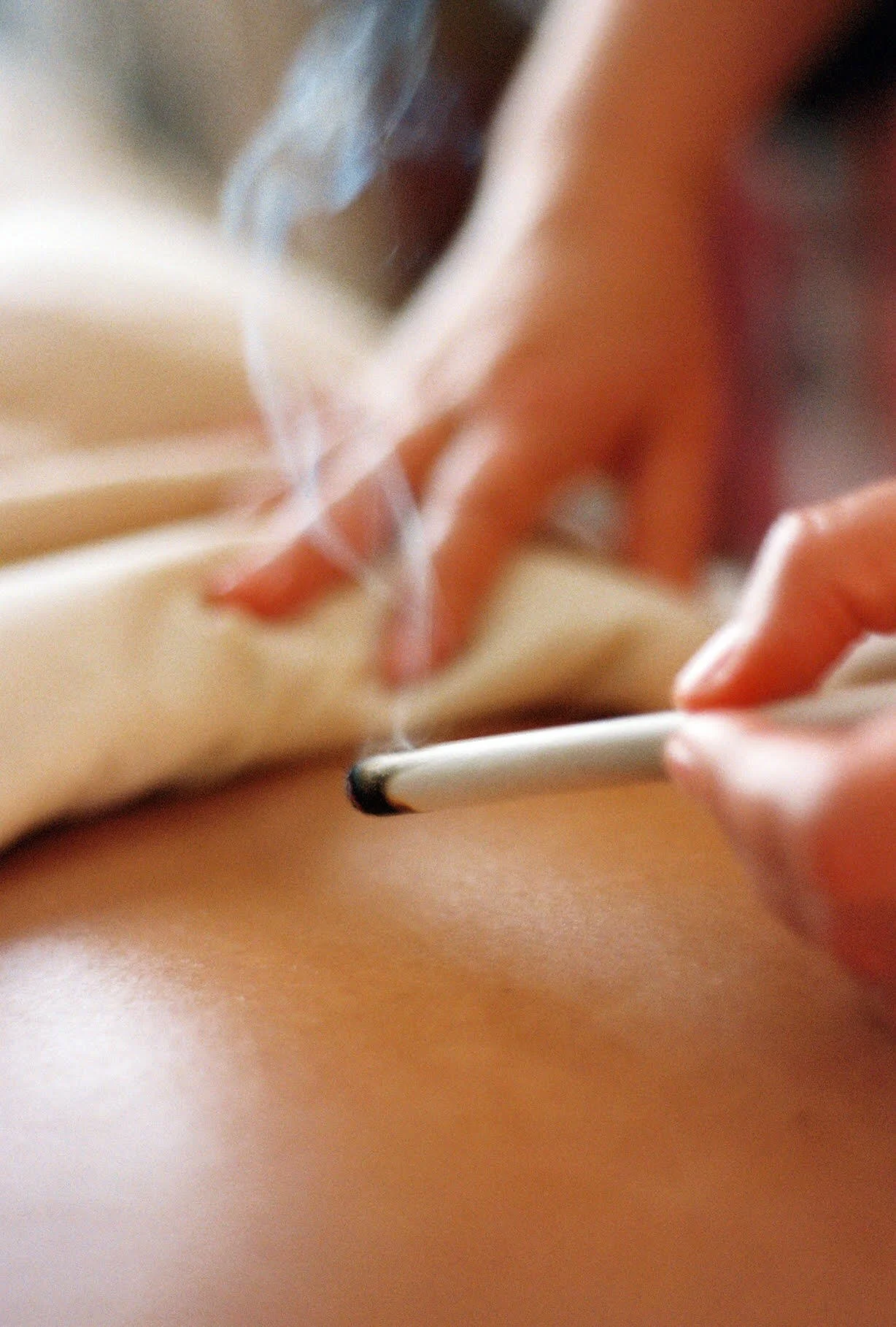 Moxibustion