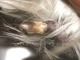 Lupoid Onychodystrophy-1.jpeg