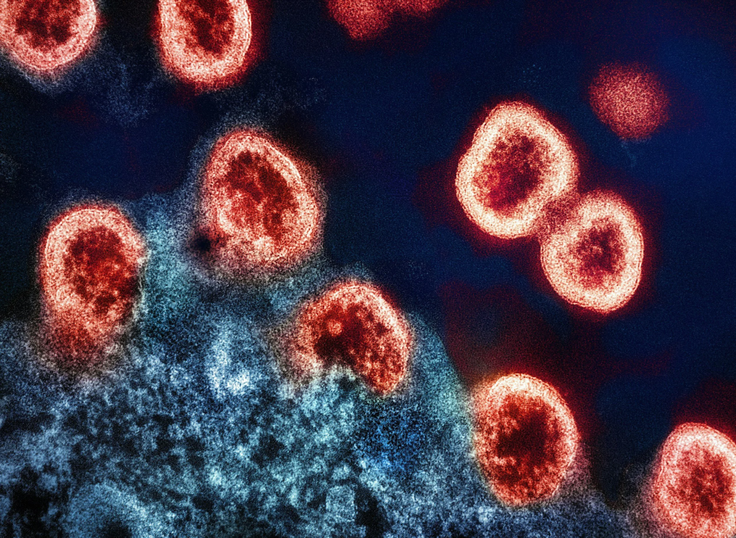 immune system