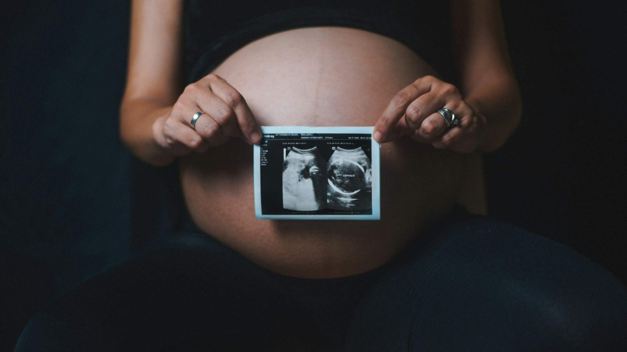 pregnant woman holding ultrasound result