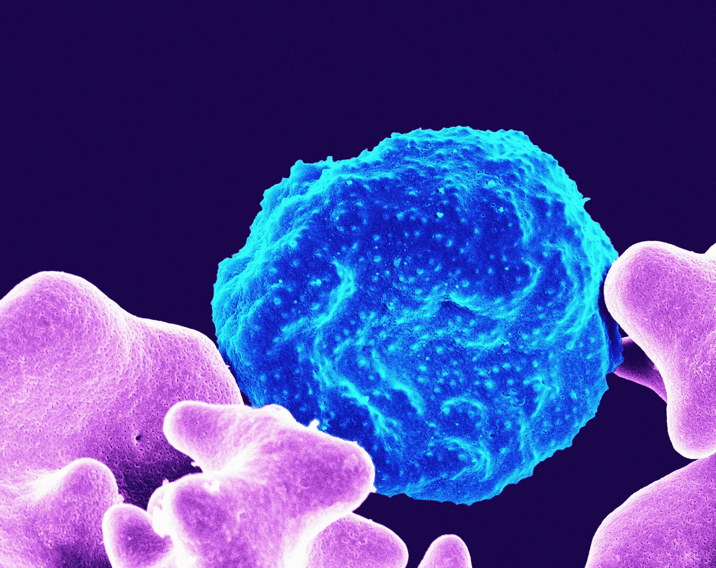 Cyclosporiasis: What You Need to Know About This Summer Foodborne Illness