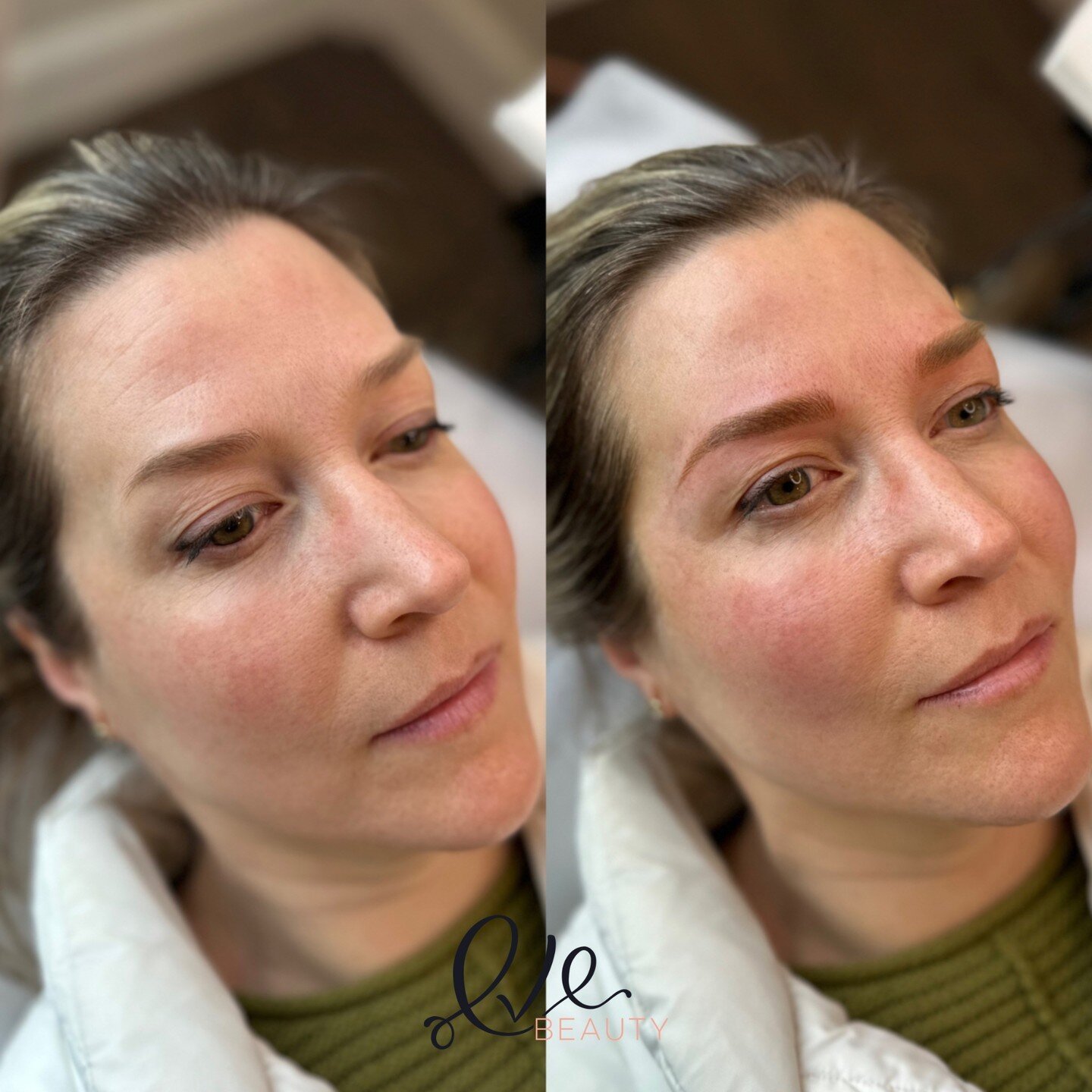 DID YOU KNOW? The healing process is not always what you expect. 

After the first few days where your brows are dark and intense , you'll notice it start to peel! Its important to remember not to pick at the brows at this time!! This helps the proce