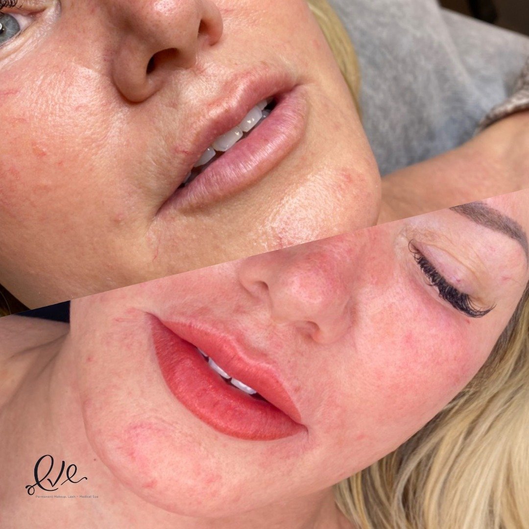 From dull to dazzling 💋 Our latest before-and-after showcases the transformative power of lip blush. Say goodbye to lackluster lips and hello to a vibrant, full-of-life pout! Ready to revive your smile? Book your lip blush appointment today at https