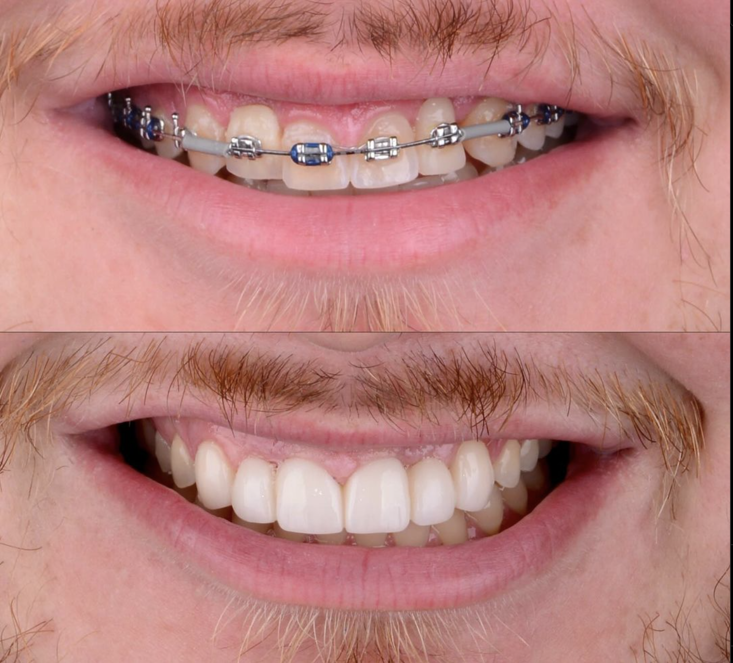 Screenshot 2024-10-31 at 11.14.44 p.m..png