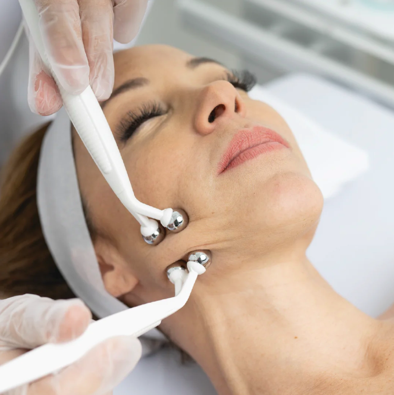 MyoLift Facial Treatment San Diego