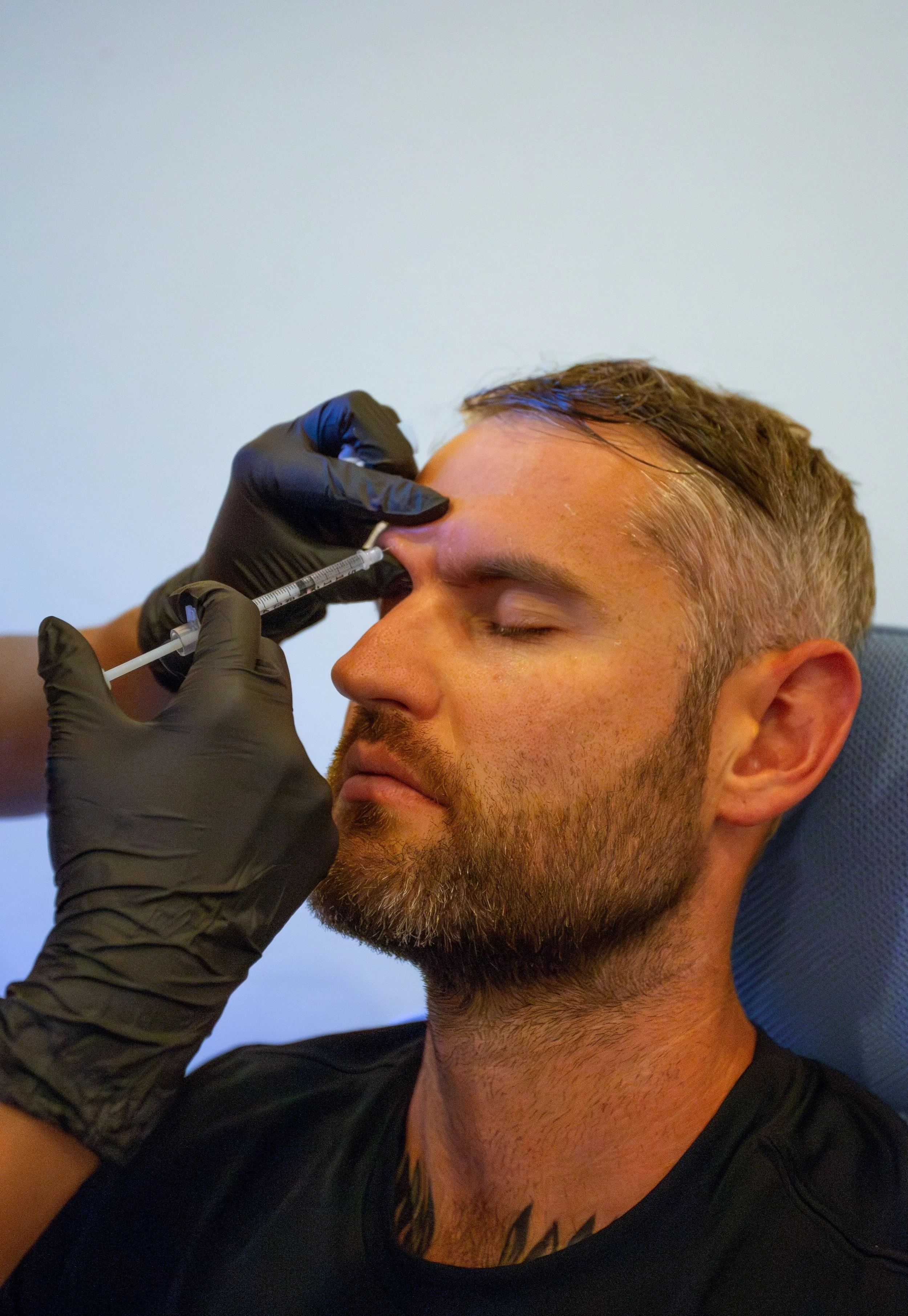 Anti-Wrinkle Unveiled | Mastering the Art of Youthful Skin