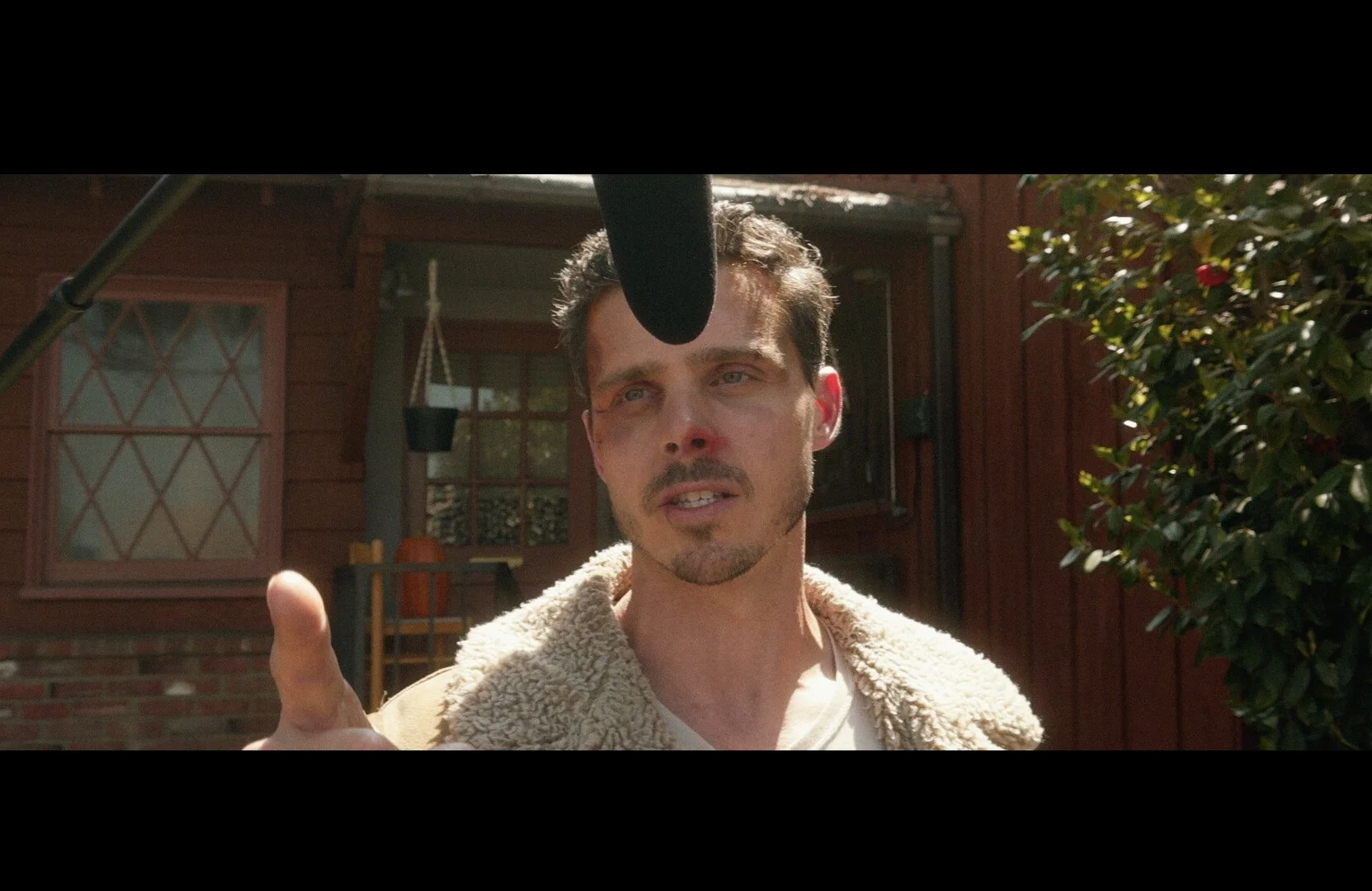 A man with short brown hair, a beard, and a bruised face stands outdoors under a bright sun, appearing distressed, with a microphone or boom pole positioned above his face.