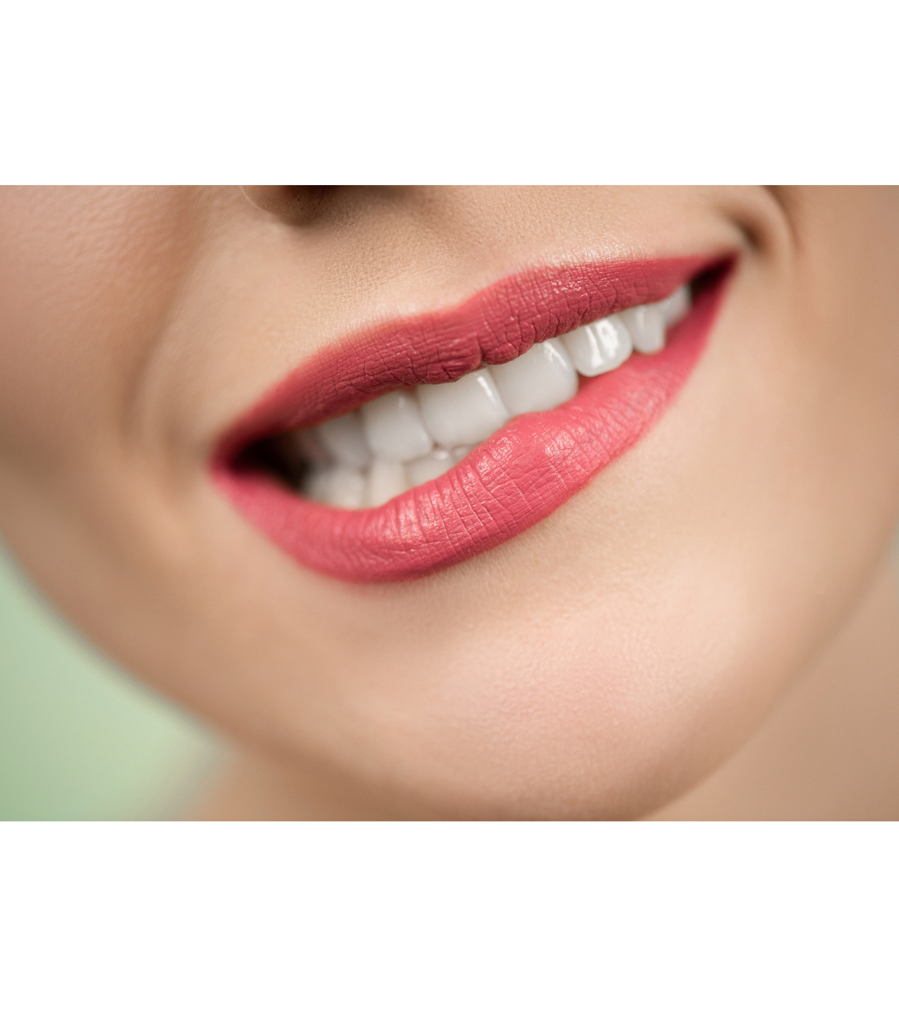 Close-up de um sorriso com lábios rosados e dentes brancos.