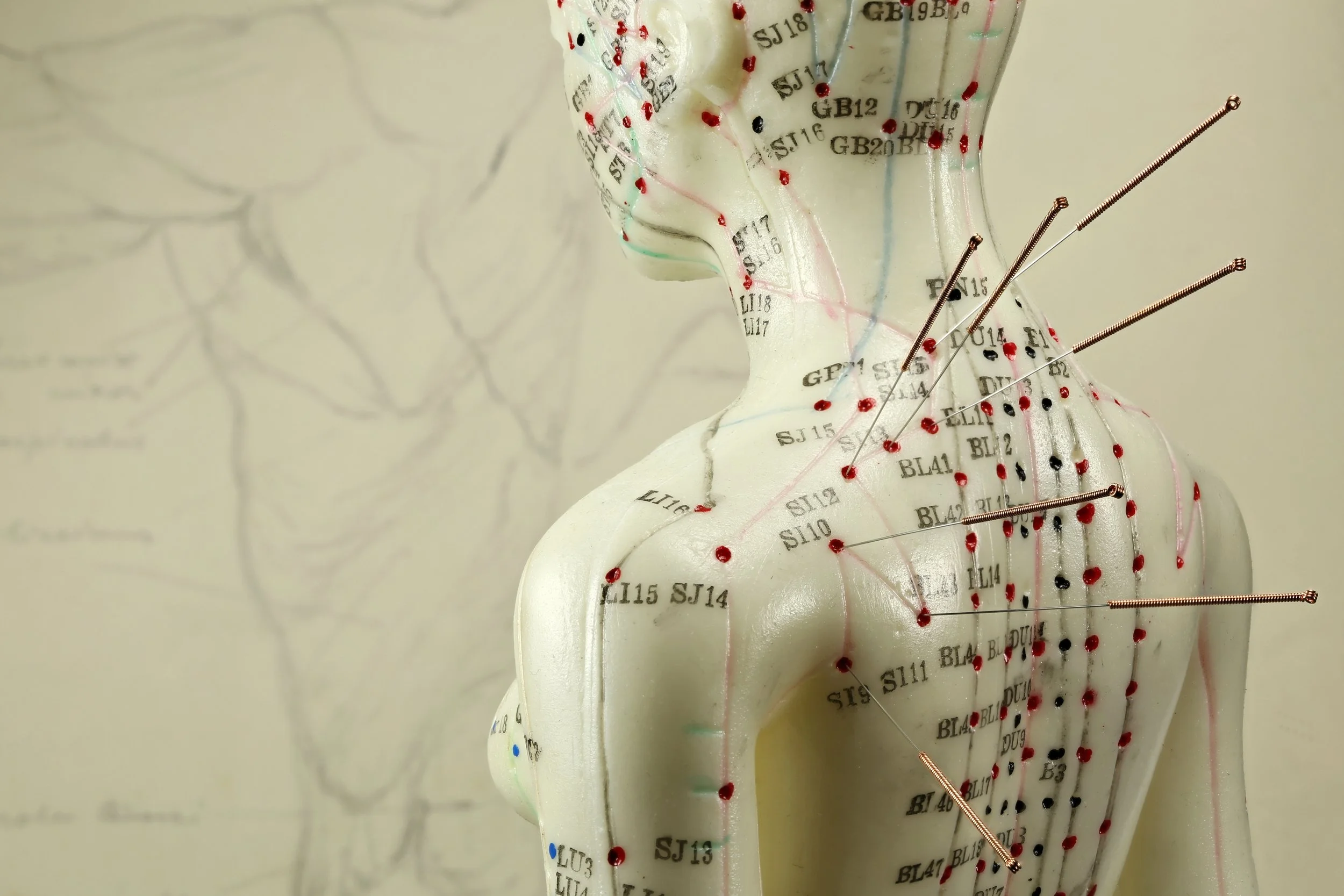 Why More People Are Turning to Acupuncture for Modern Wellness