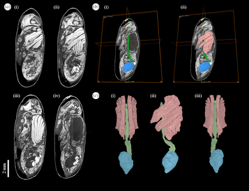 Calliphora vicina (Diptera: Calliphoridae) female pharate adult at the end of the intra-puparial period