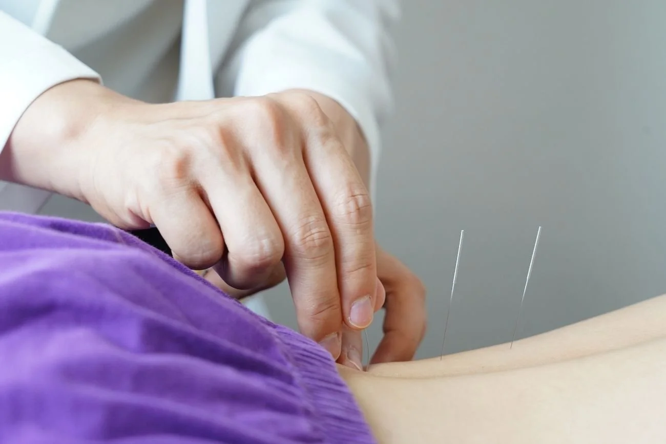 acupuncture treatment for hip pain