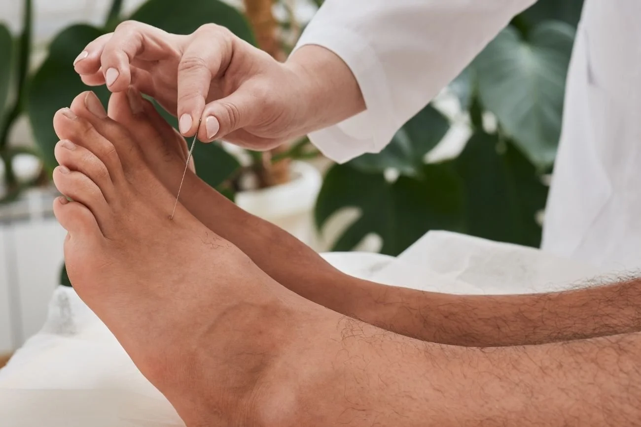 acupuncture for diabetic neuropathy in feet