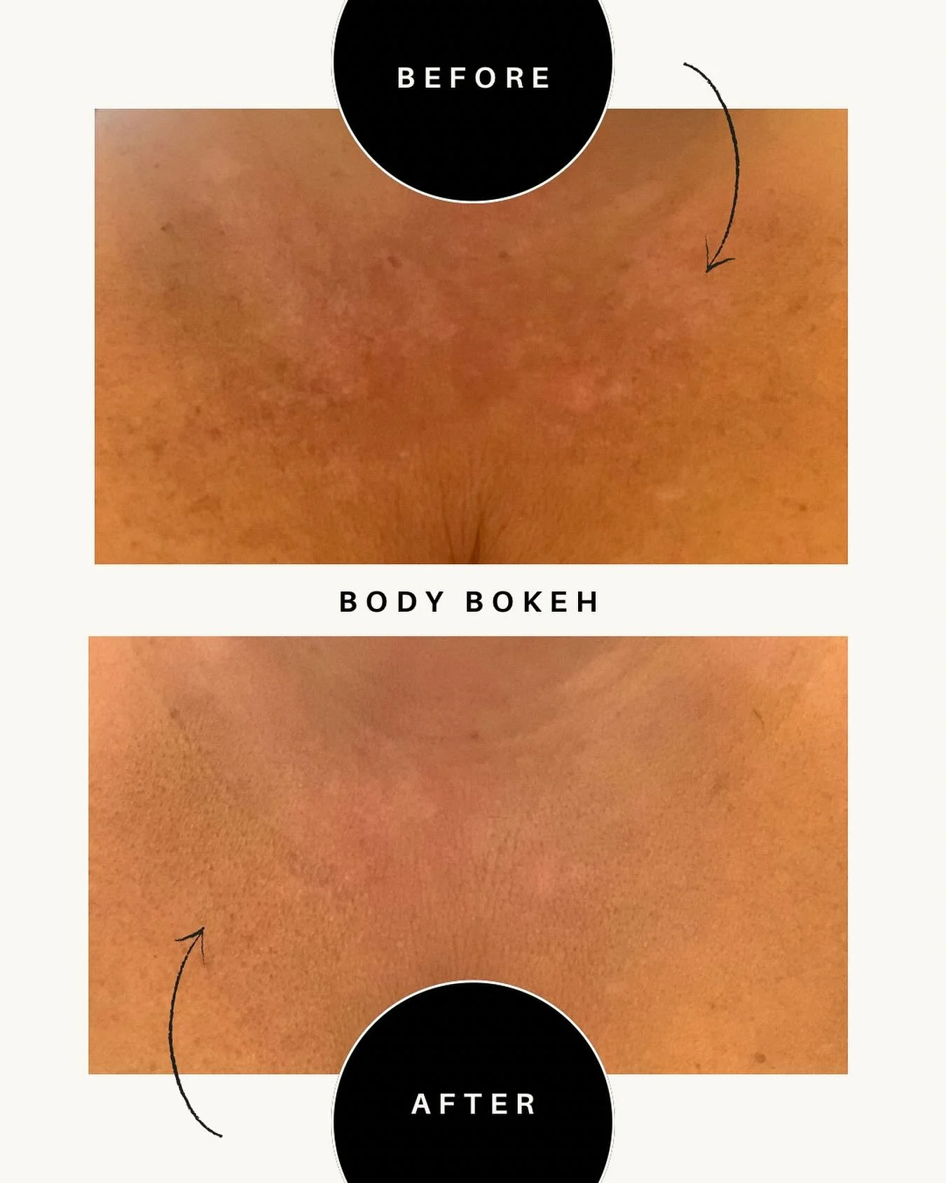 No retouching, no filters &mdash; just Body Bokeh.
Blurring imperfections for skin that looks as smooth as it feels. ✨ #cleanbeauty