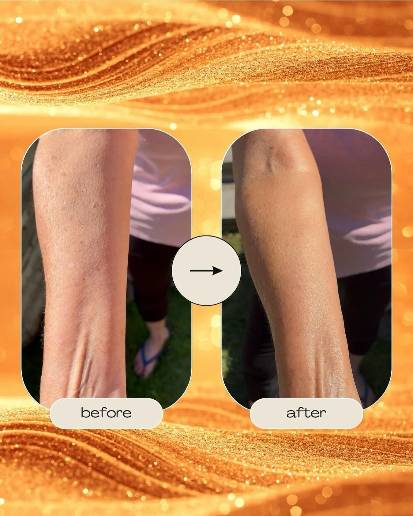 No edits. No filters. Just glow. 🌟
Body Bokeh&rsquo;s radiance-blur formula smooths, hydrates, and leaves skin glowing in every light. Your skin, but better.🤩

#bodybokeh #glowingskin #gratefulandglowing #radiantskin #skincream