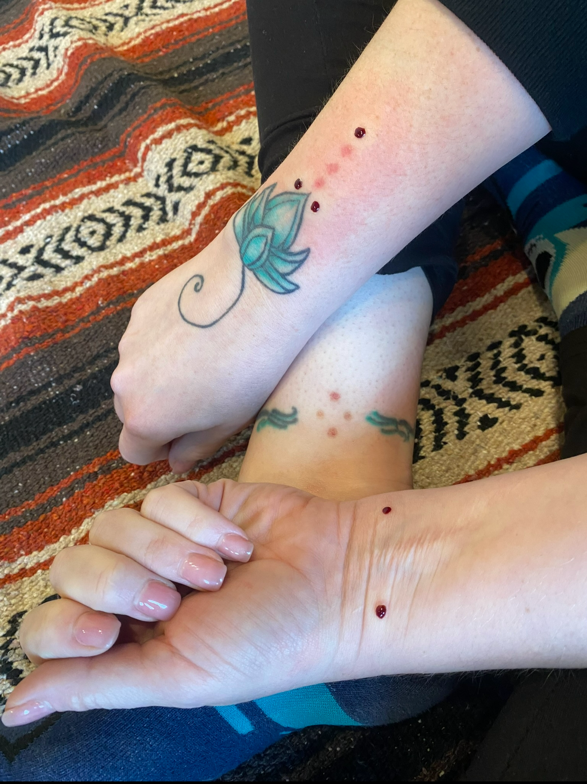Close-up of fresh Kambo points on the wrist and ankle of a participant at Ahavah Gardens, showing ceremonial application, healing intention, and sacred integration space.