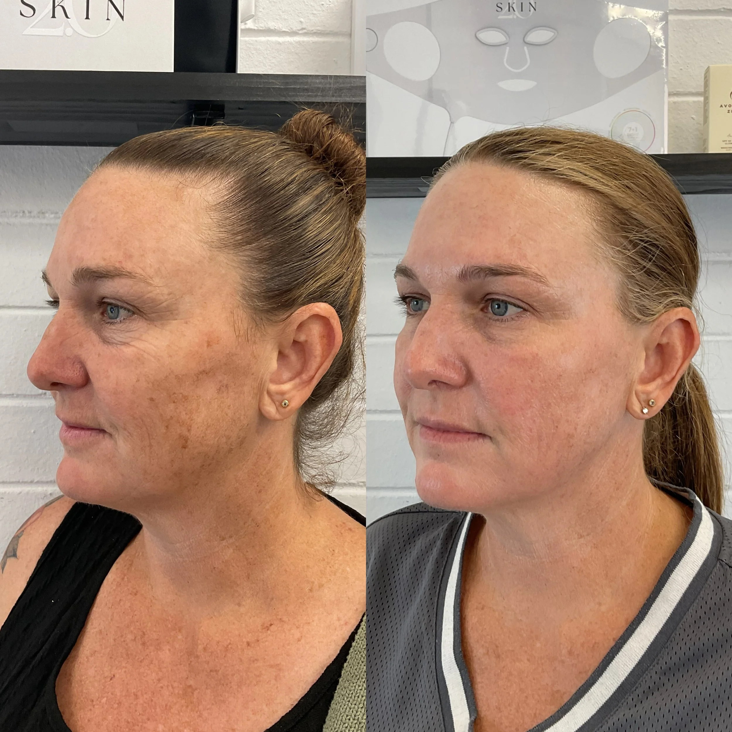 photo-output 16.jpeg