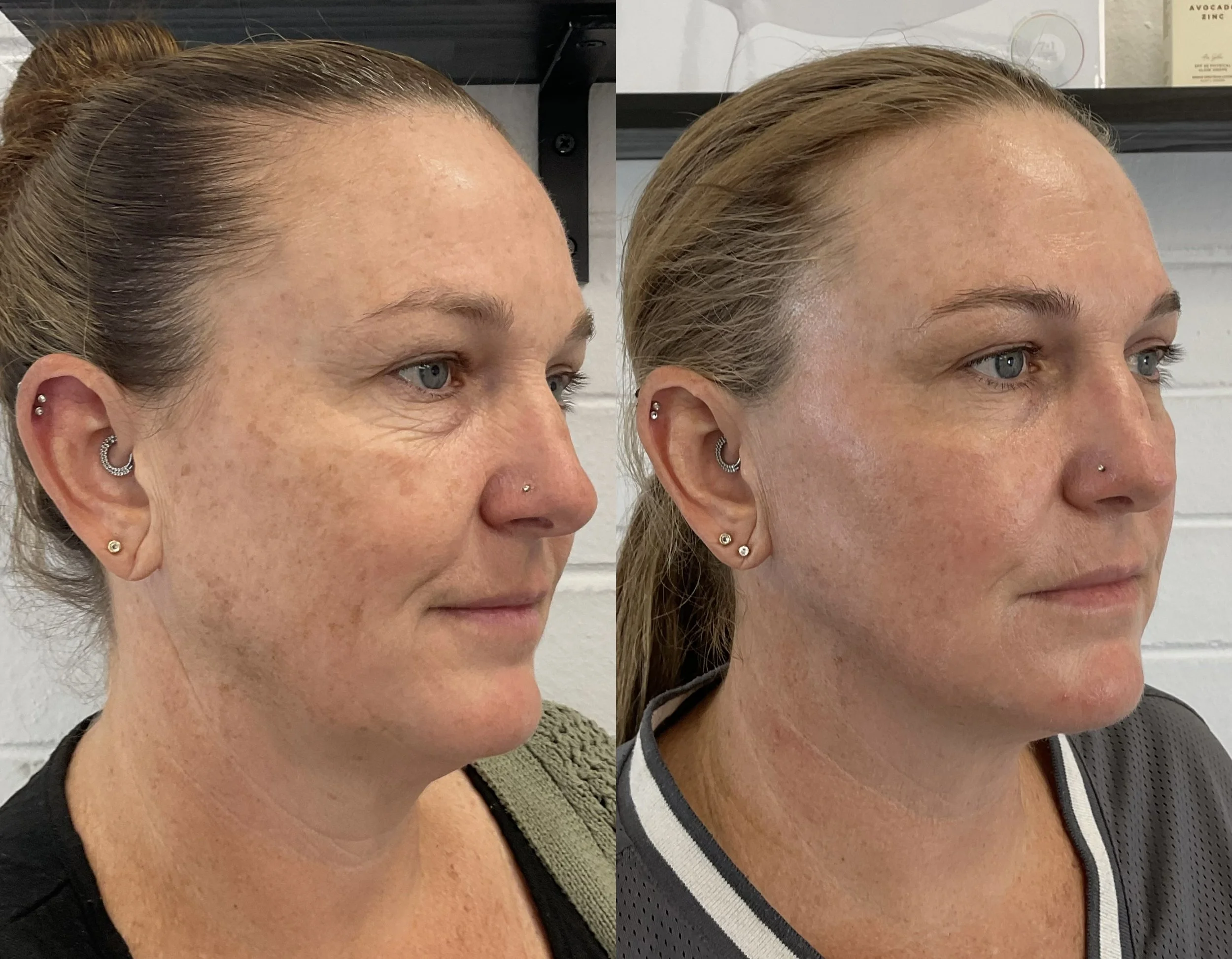 Skin Transformations