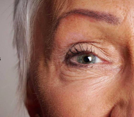 4 Myths About Wrinkles Debunked