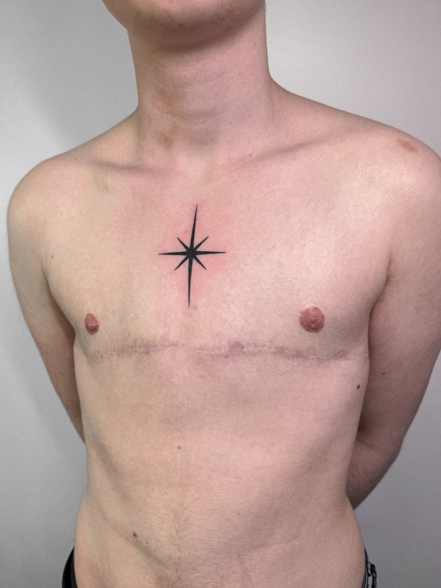 One of my favorites, thank you so much for trusting me 🥹💚💚
.
.
.
.
#amsterdamtattoo #whimsicaltattoo #surrealismtattoo #blackworktattooing #illustrativetattoos