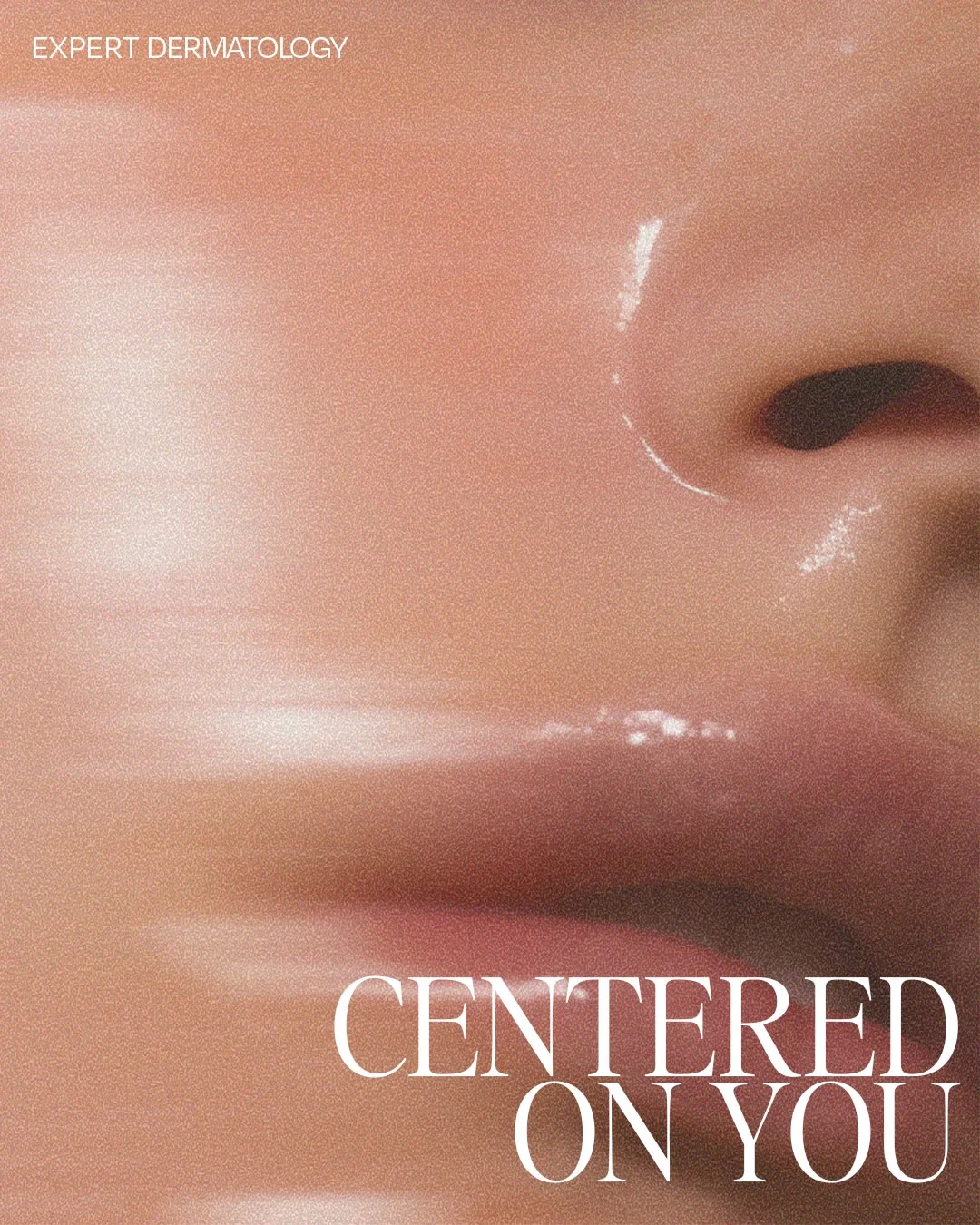 Close-up of a person's nose and lips with a glossy shine, with text overlay reading 'Centered on You' and 'Expert Dermatology'.
