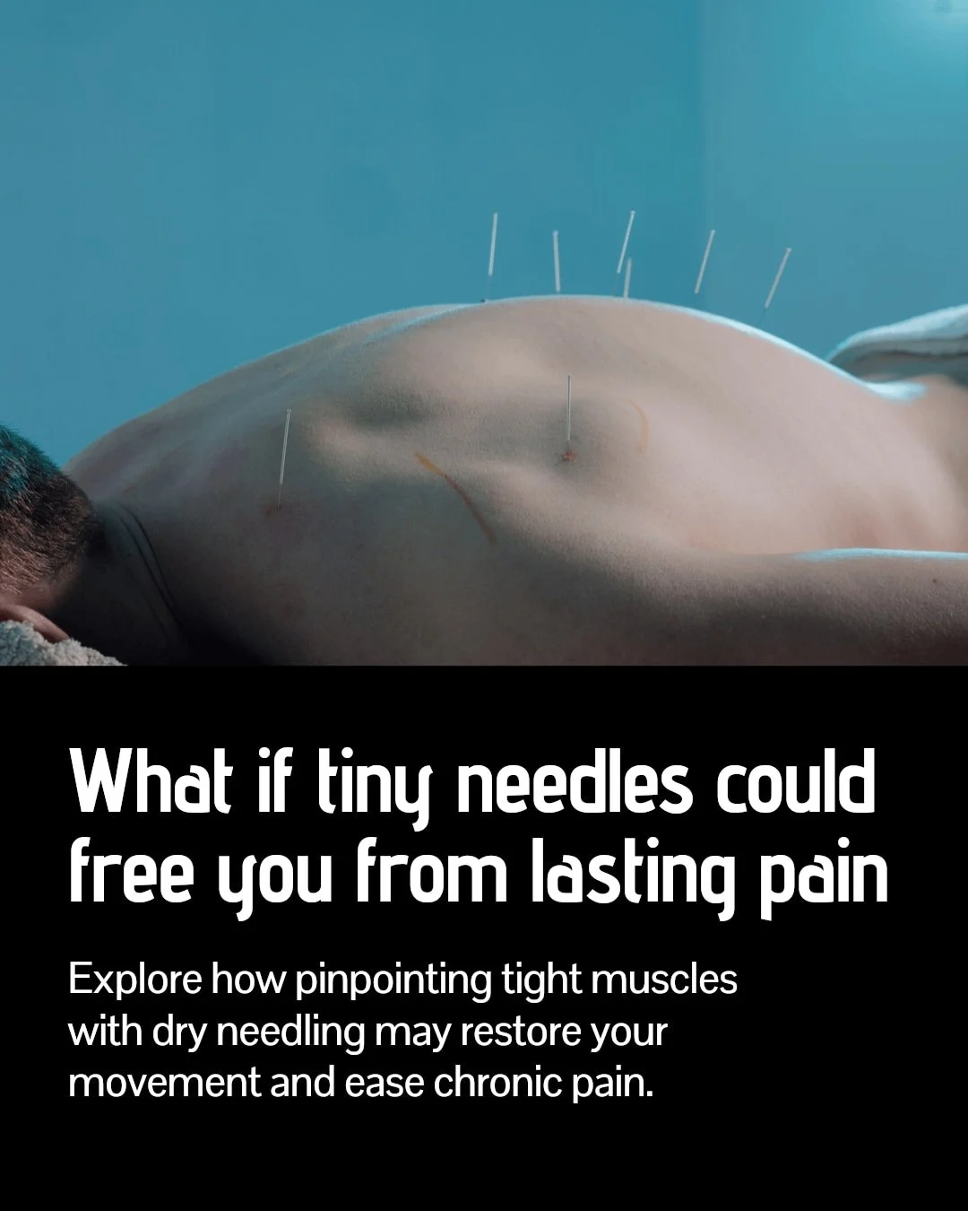 Struggling with chronic pain that just won't quit?

Functional dry needling might be the game-changer you need. This technique targets tight muscles and trigger points using tiny needles, helping to restore blood flow and ease pain.

It's not just ab