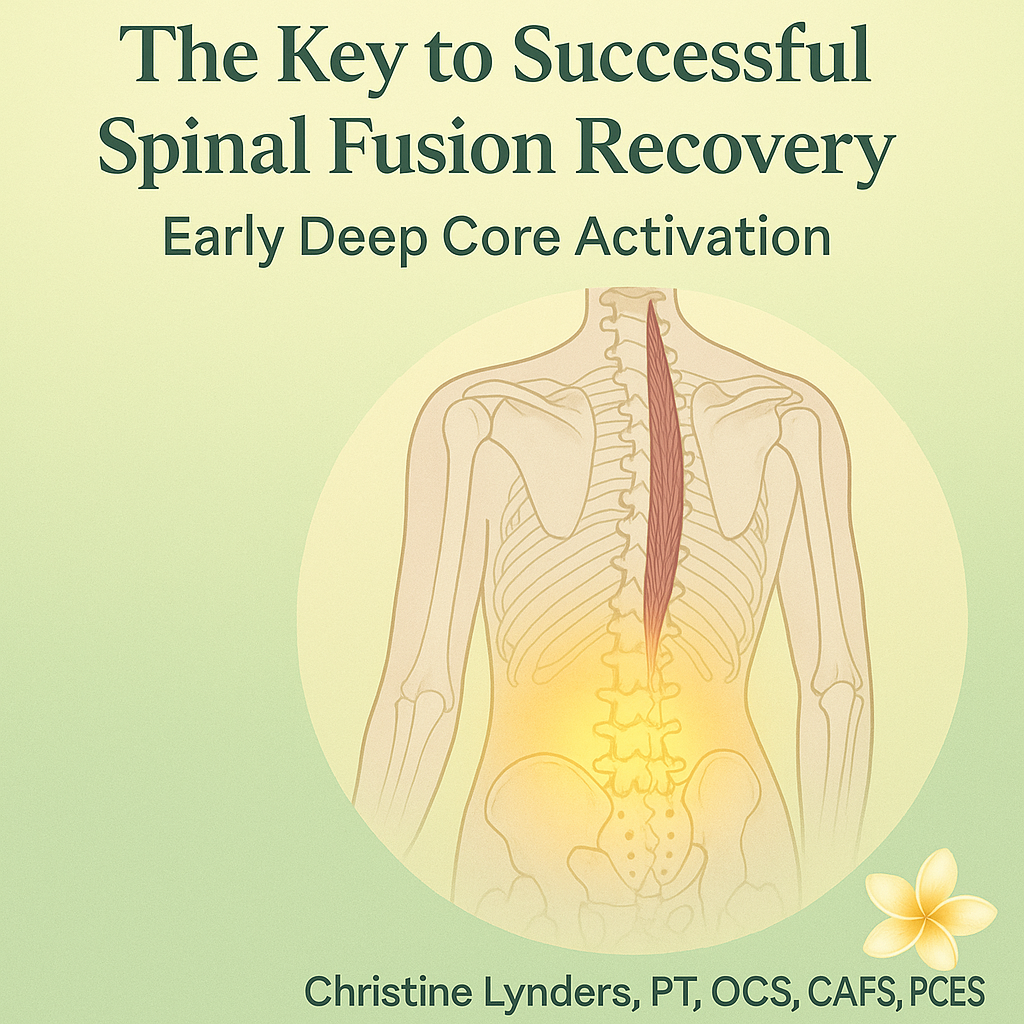 The Key to Early and Successful Recovery from a Spinal Fusion