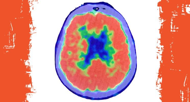 How to Know If Your Positioning Problem Is Strategic or Neurological