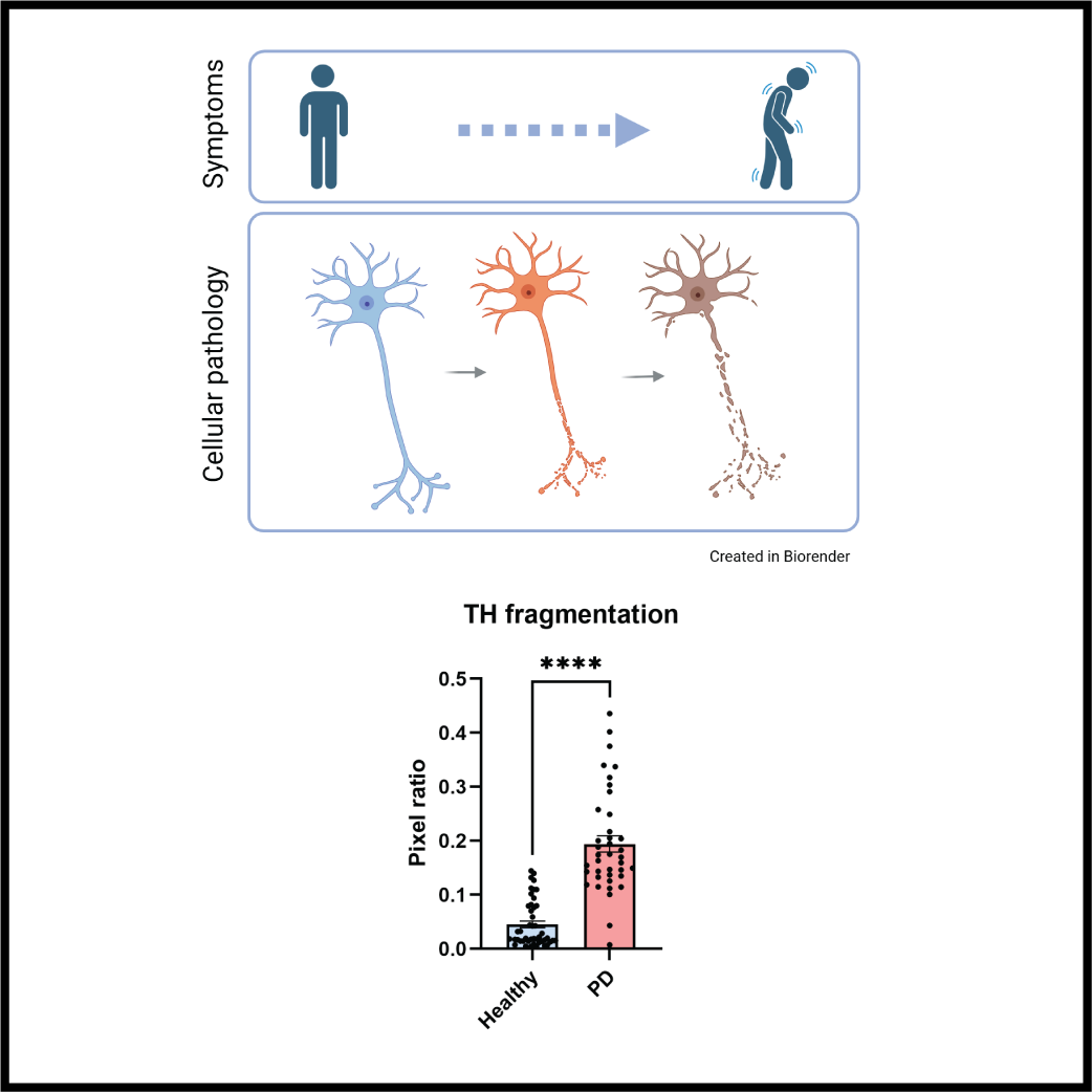 OrganoTherapeutics Newsletter - April 2025 ; Assessment and quantification of dopaminergic neurite fragmentation