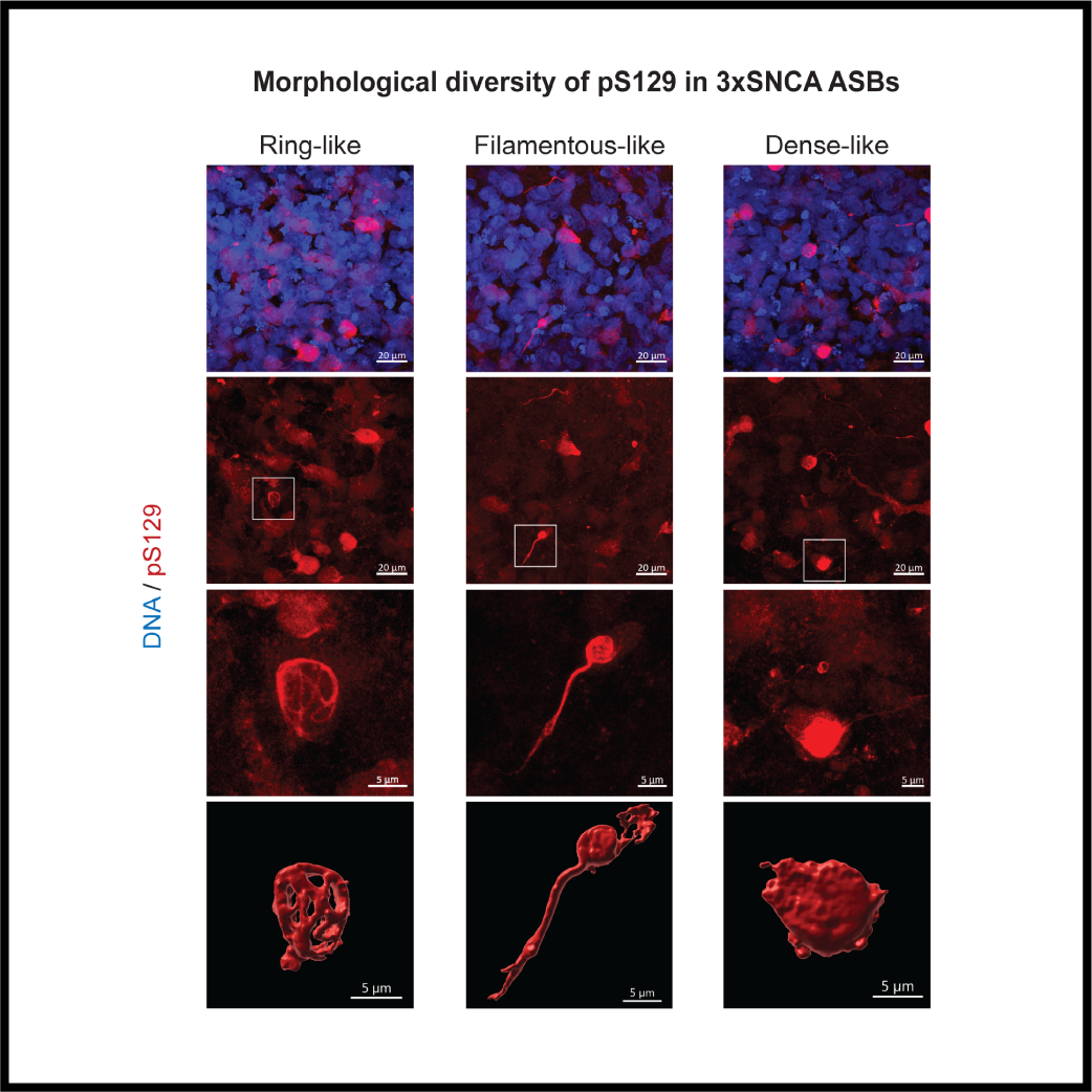 Endogenous accumulation of alpha-synuclein in microglia-containing organoids; a new research breakthrough