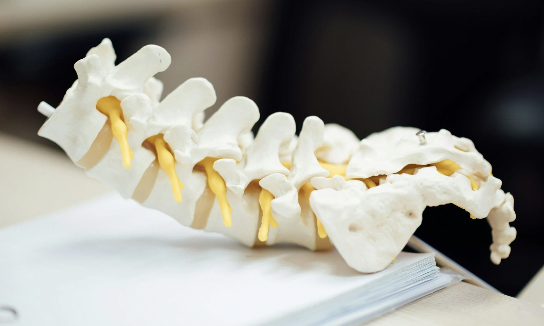 Living (Well) With Scoliosis: How Physiotherapy and Pilates Can Support Your Spine