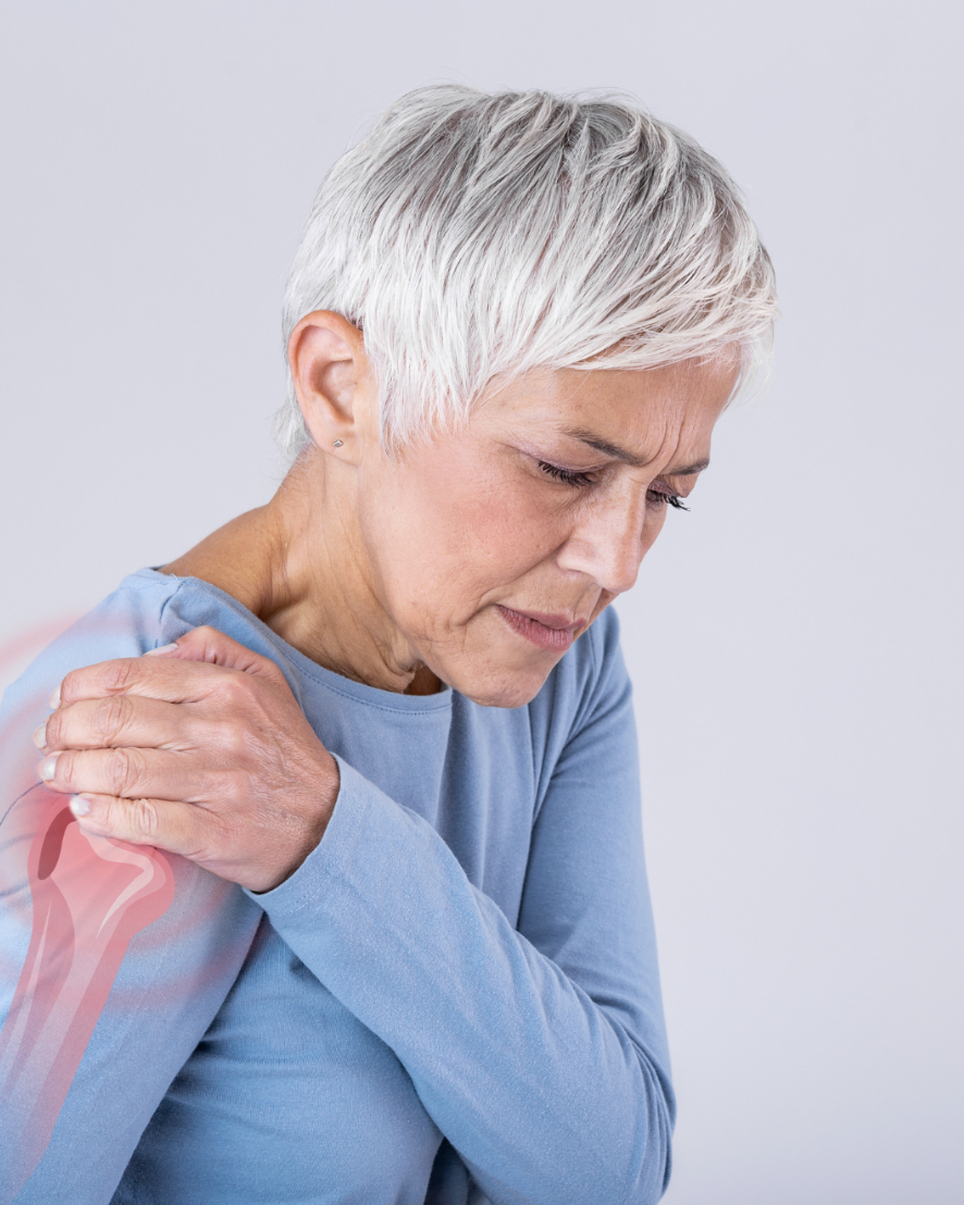 Frozen Shoulder and Menopause: When Hormones Affect Your Joints