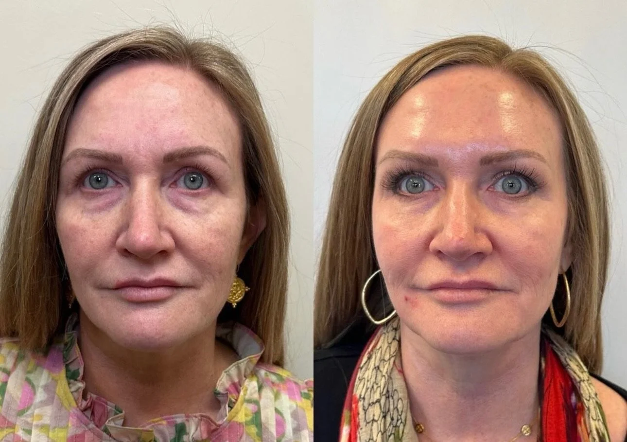 PRS and Zo Skin Health