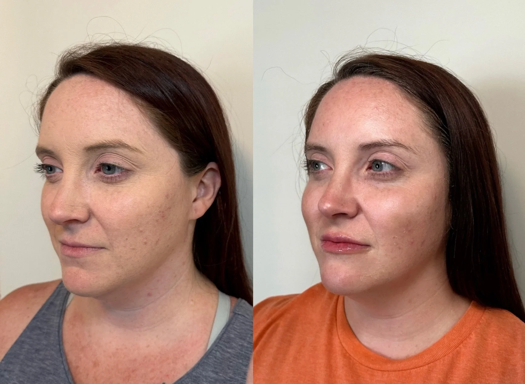 full facial balancing