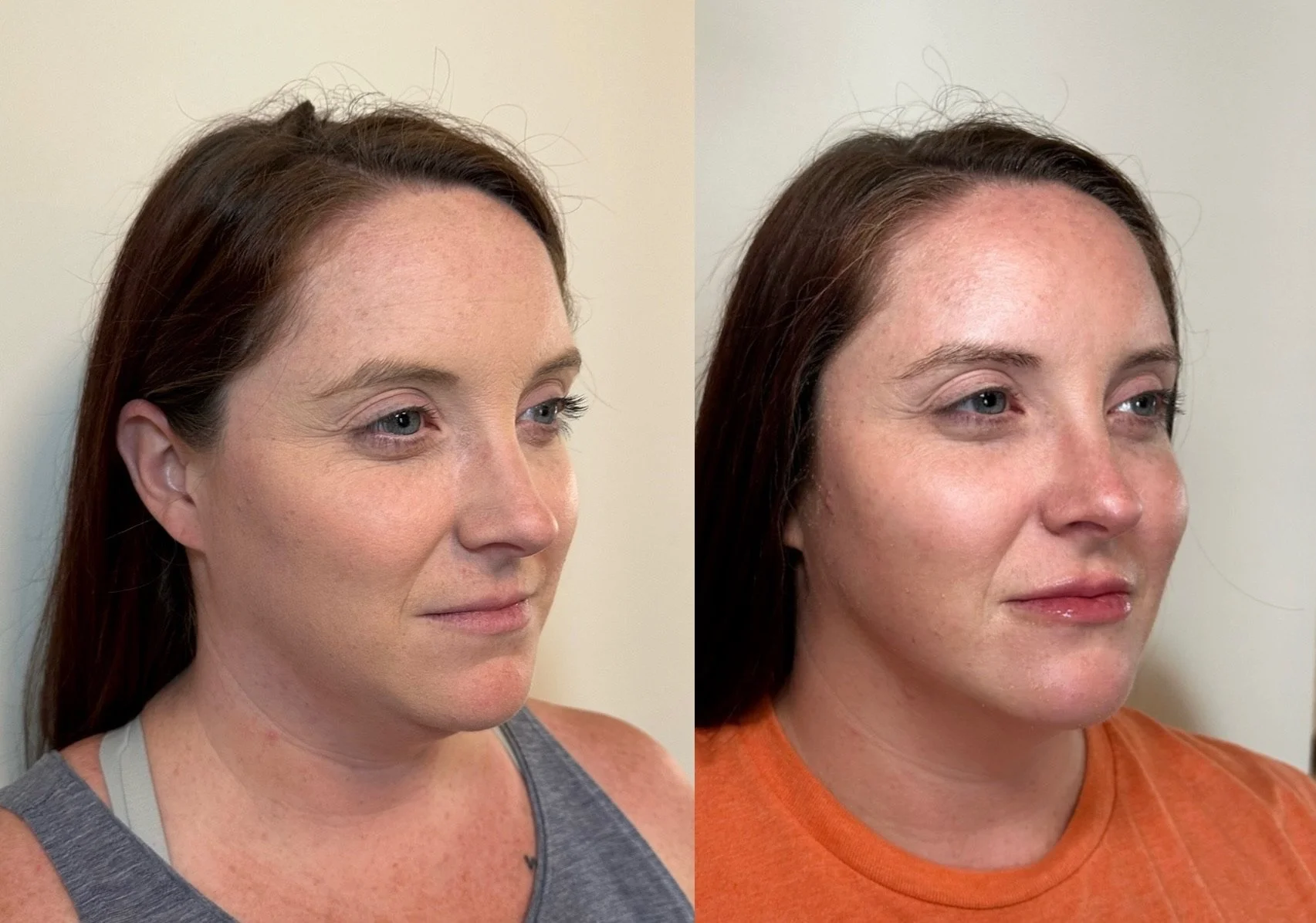 full facial balancing