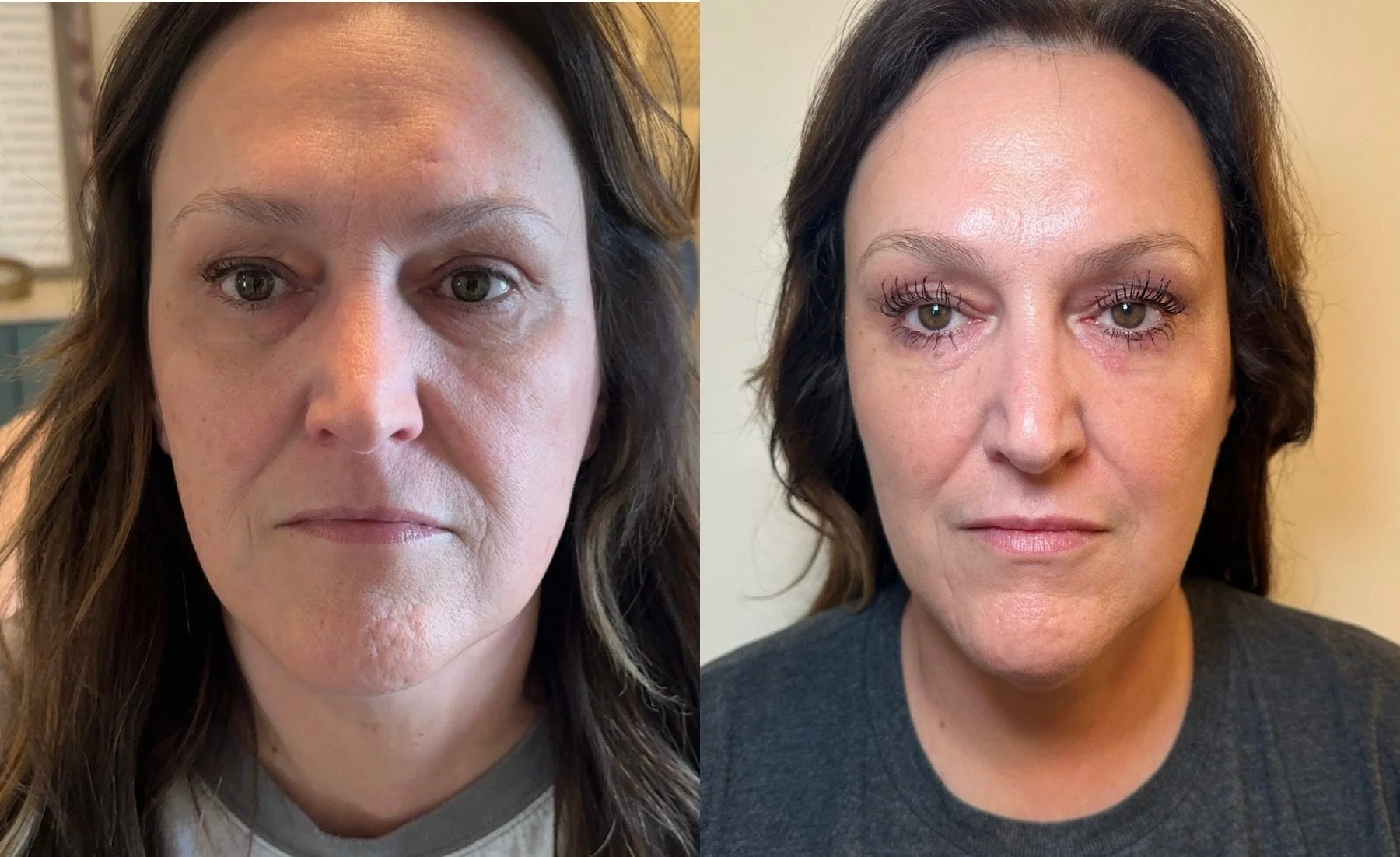 ZO skin care regimen