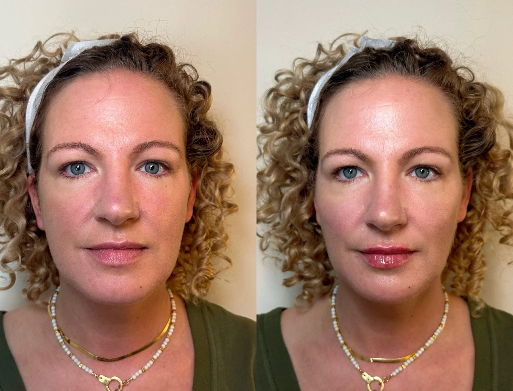 full facial balancing