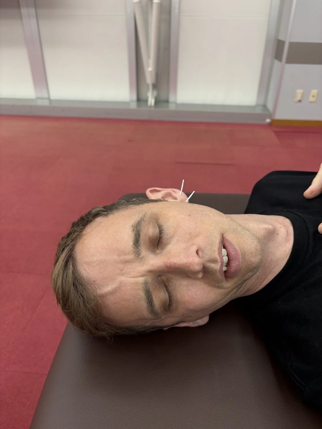 Dry Needling in Geelong: Benefits, What to Expect &amp; How It Can Help You Move Better