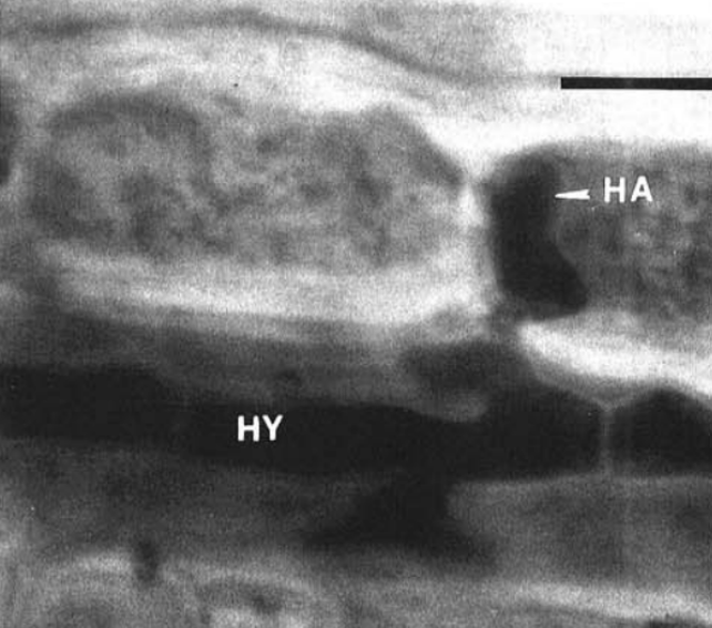 Secondary Hyphae &amp; Haustoria (biotrophic feeding structure)